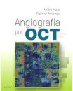 AAngiografia por OCT