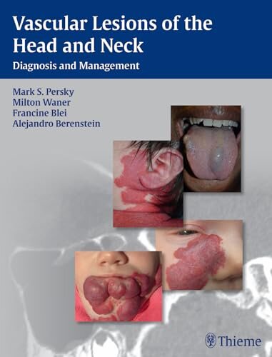 Vascular Lesions Head Neck Diag.Management