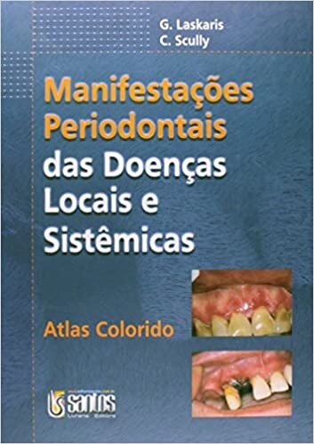 Manifestações Periodontais das Doenças Locias e Sistêmicas