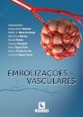 Embolizações Vasculares