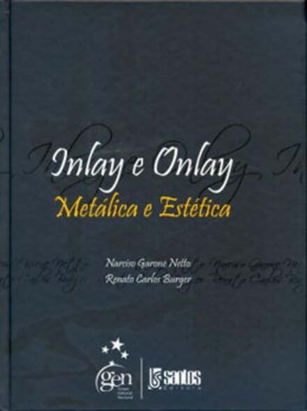 Inlay E Onlay Metálica E Estética