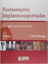 Restaurações Implantossuportadas Guia Passo A Passo