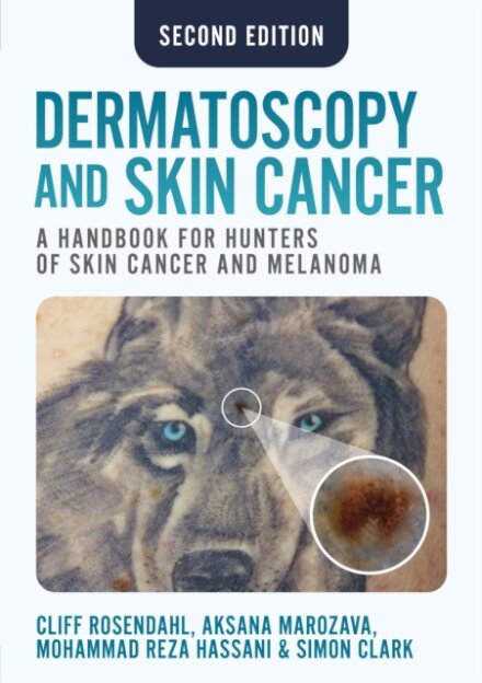 Dermatoscopy and Skin Cancer, second edition