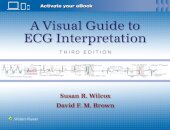 A Visual Guide to ECG Interpretation: Print + eBook with Multimedia