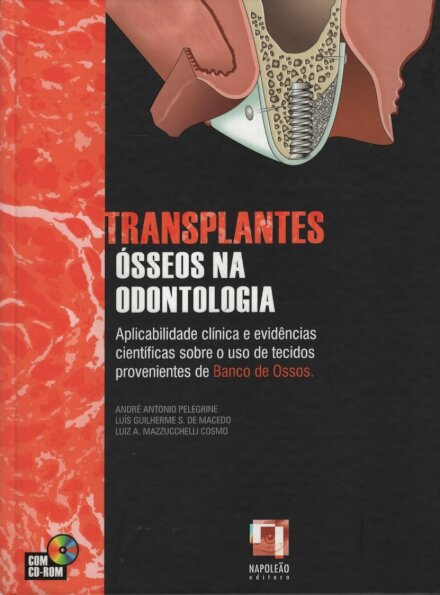 Transplantes Ósseos na Odontologia