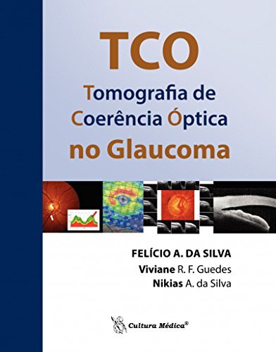 TCO - Tomografia de Coerência Óptica no Glaucoma
