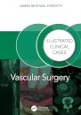 Vascular Surgery:
