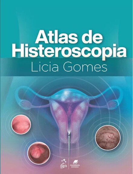 Atlas de Histeroscopia 1/25