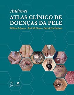 Andrews Atlas Clínico De Doenças Da Pele