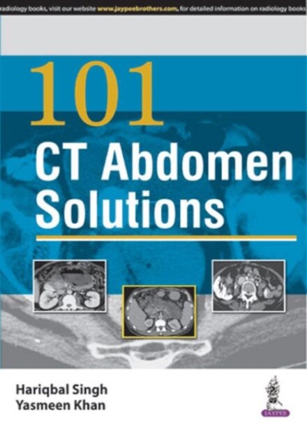101 CT Abdomen Solutions