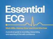 Essential ECG