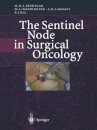 The Sentinel Node in Surgical Oncology