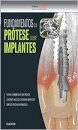 Fundamentos Da Prótese Sobre Implantes