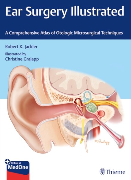 Ear Surgery Illustrated