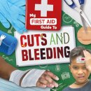 Cuts and Bleeding