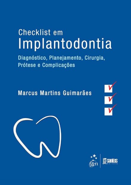 Checklist Em Implantodologia Diagnóstico, Planejamento, Cirurgia, Prótese E Complicações