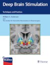 Deep Brain Stimulation