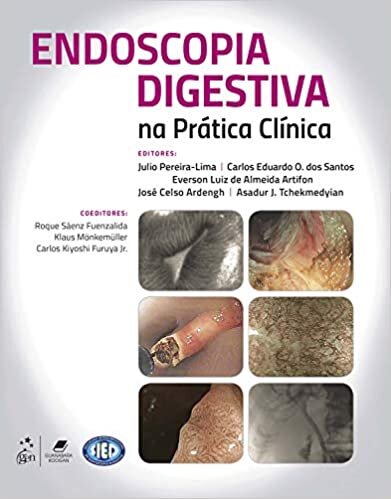 Endoscopia Digestiva Na Prática Clínica