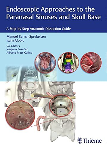 Endoscopic Approaches Paranasal Sinuses Skull Base