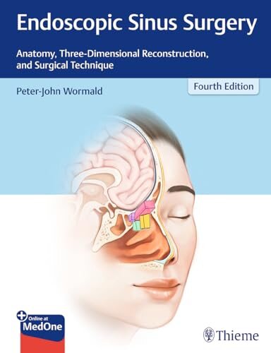 Endoscopic Sinus Surgery (4Ed)