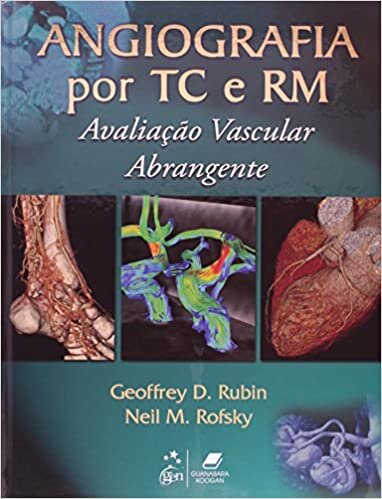 Angiografia por TC e RM Avaliação Vascular Abrangente