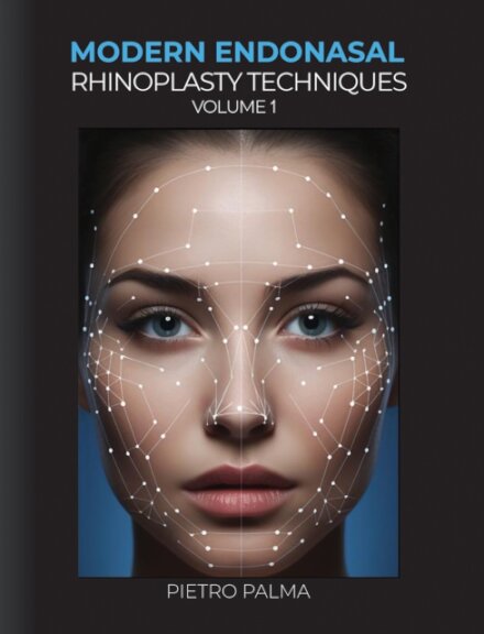 Modern Endonasal Rhinoplasty Techniques – Volume 1
