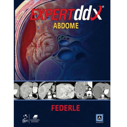 Expert Ddx Abdome