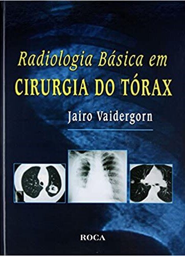 Radiologia Básica Em Cirurgia Tórax