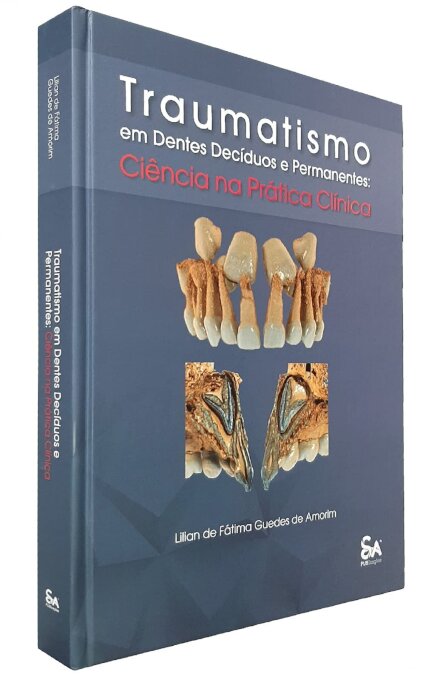 Traumatismo Em Dentes Decíduos E Permanentes
